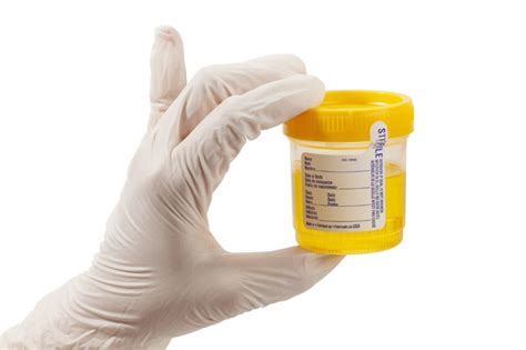 drop a ua for drug test|urinalysis drug testing.